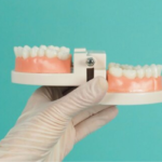 Difference Between Basal and Conventional Implants