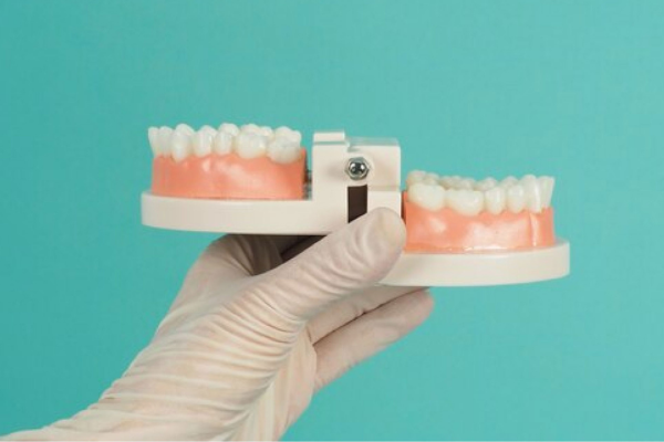 Difference Between Basal and Conventional Implants